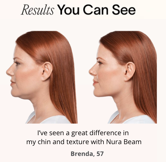 NuraSculpt™ Neck Band